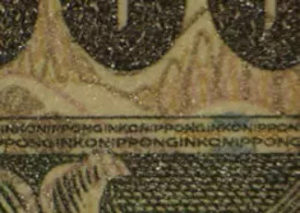 cariesImg008 - マウスピース矯正/ホワイトニング/美容歯科は銀座の歯医者|デンタルサロンナチュール銀座