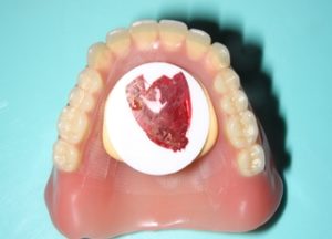 ゴシックアーチ - マウスピース矯正/ホワイトニング/美容歯科は銀座の歯医者|デンタルサロンナチュール銀座