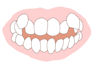 facelineimg_04 - マウスピース矯正/ホワイトニング/美容歯科は銀座の歯医者|デンタルサロンナチュール銀座