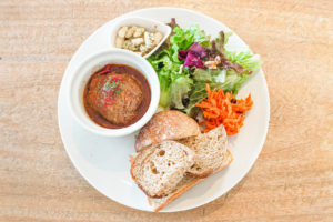 femaleorthoimg_04 - マウスピース矯正/ホワイトニング/美容歯科は銀座の歯医者|デンタルサロンナチュール銀座