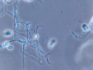 真菌（カビ）が確認できます。