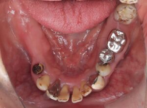 IMG_6676 - マウスピース矯正/ホワイトニング/美容歯科は銀座の歯医者|デンタルサロンナチュール銀座