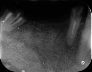 IX20230911_145527_4238_31857572 - マウスピース矯正/ホワイトニング/美容歯科は銀座の歯医者|デンタルサロンナチュール銀座