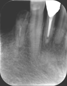 IX20230928_162436_6033_04545547 - マウスピース矯正/ホワイトニング/美容歯科は銀座の歯医者|デンタルサロンナチュール銀座