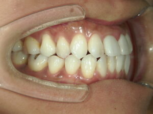 SHOFU DENTAL DIGITAL CAMERA - マウスピース矯正/ホワイトニング/美容歯科は銀座の歯医者|デンタルサロンナチュール銀座