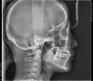 6009a_192823_1840_20623878 - マウスピース矯正/ホワイトニング/美容歯科は銀座の歯医者|デンタルサロンナチュール銀座